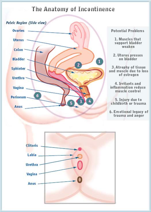 Incontinence Diagram