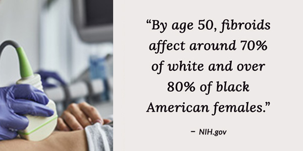 By age 50, fibroids affect around 70% of white and over 80% of Black American females. 