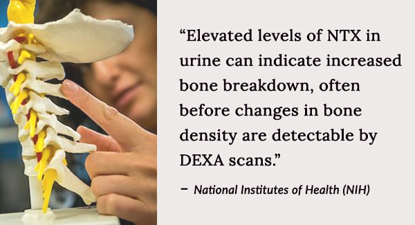 Elevated levels of NTX in urine can indicate increased bone breakdown